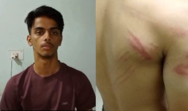 सेंट जोसेफ स्कूल में पढ़ने वाले तीन दोस्तों ने मिलकर एक छात्र की अगवा की पिटाई, पुलिस ने किया केस दर्ज