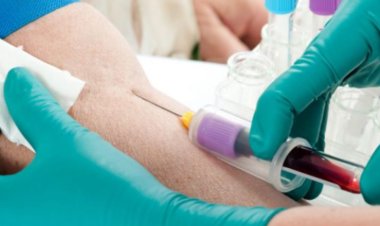 CBC Test in Hindi : सीबीसी टेस्ट क्या है? क्यों कराया जाता है सीबीसी टेस्ट,नॉर्मल रेंज एवं खर्च