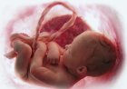 What is cord blood? Myths Related To Umbilical Cord Blood Donation