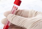 Cost of Blood Test in Ontario, Canada
